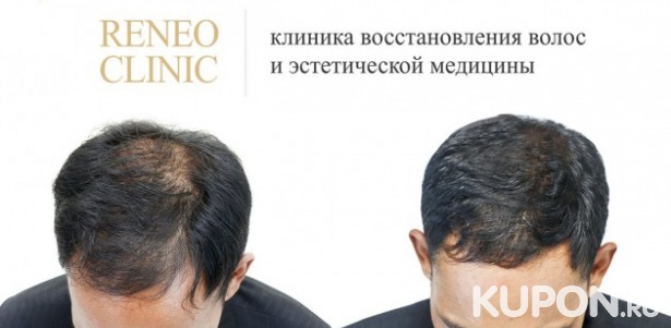 Скидки до 73% на пересадку и лечение волос в RENEO CLINIC. От 85 р. за пересадку волос, от 1440 р. за мезотерапию волос. Плазмотерапия, программы против выпадения волос