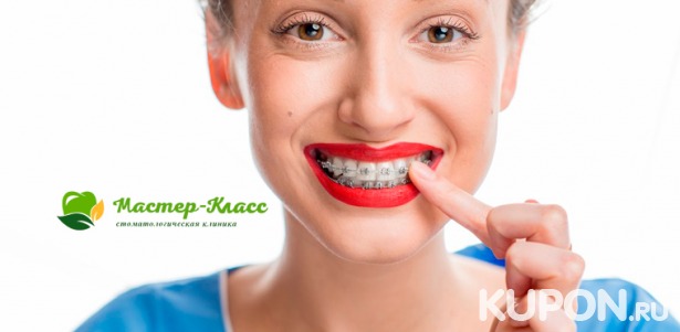 Скидка до 79% на металлические или керамические брекеты в стоматологии «Мастер-класс»