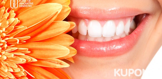 Отбеливание Amazing White Professional, ультразвуковая чистка зубов и чистка Air Flow в стоматологии CID. Скидка до 90%