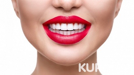 Имплантация зубов по системе «всё включено» в сети стоматологий Zubof.ru