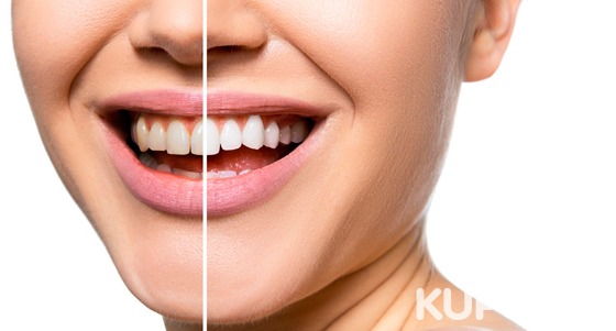 Скидка до 90% на УЗ-чистку зубов, чистку Air Flow, отбеливание Amazing White или Belle, лечение кариеса, эстетическую реставрацию или вызов стоматолога на дом от стоматологии «Гамма»