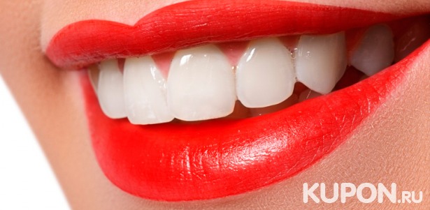 Скидка до 83% на УЗ-чистку зубов, отбеливание по технологии Amazing White, установку металлокерамических коронок, лечение кариеса в стоматологиях «Дент-Перфект» и «СтомИнвест»