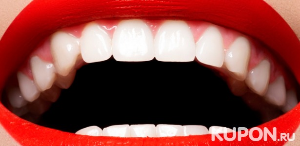 Чистка зубов, ламповое отбеливание Amazing White или Belle, лечение кариеса, эстетическая реставрация, а также вызов стоматолога на дом от стоматологии «Гамма». Скидка до 90%