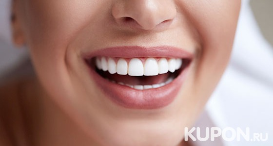 Скидка до 60% на 3-этапное косметическое отбеливание зубов White Smile в студии «Технологии красоты»