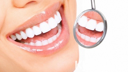 Лечение кариеса или реминерализация зубов в стоматологической клинике «Корона-Дент»