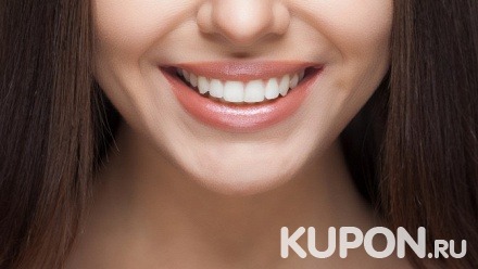Отбеливание зубов на выбор, лечение кариеса с установкой пломбы, комплексная гигиена полости рта или эстетическая реставрация зубов в стоматологической клинике «Мармелад»