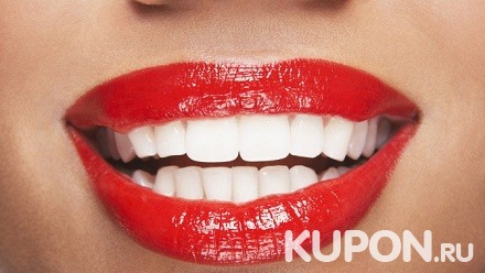 Процедура косметического экспресс-отбеливания зубов на выбор в «Студии White & Smile» в ТРЦ «Макси»