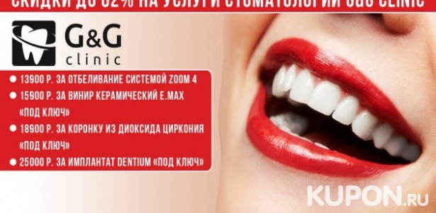 Скидки до 62% на услуги стоматологии G&G CLINIC! 990 р. за чистку зубов, 13900 р. за отбеливание системой ZOOM 4, 15900 р. за керамический винир «под ключ»