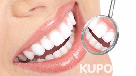 Комплексная чистка всех зубов с AirFLow и глубоким фторированием в сети стоматологических клиник «АБВДент» (1200 руб. вместо 2400 руб.)