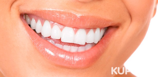 Профессиональная гигиена полости рта, отбеливание зубов Amazing White, Zoom 4, Belle и Opalescence Boost в стоматологической клинике White-Smille. Скидка до 84%