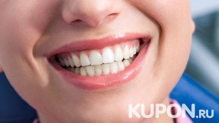 Установка пломбы или ультразвуковая чистка зубов с отбеливанием по системе AirFlow в стоматологии «МАС-дент»