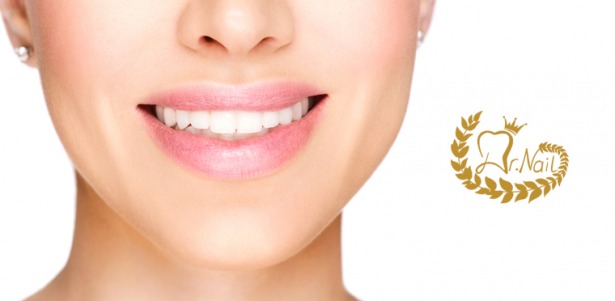 Услуги многопрофильной стоматологической клиники Dr. Nail: гигиена полости рта, лечение кариеса, реставрация зубов, установка брекет-системы, металлокерамических коронок. Скидка до 86%