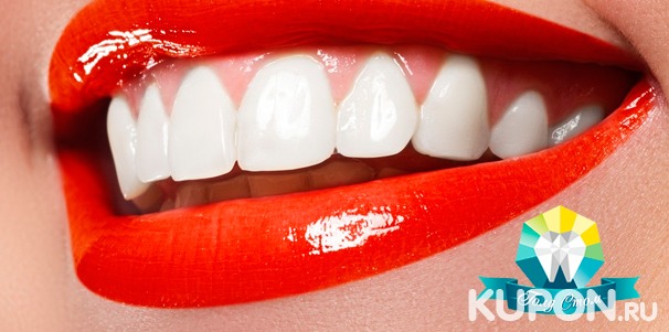 Отбеливание и ультразвуковая чистка зубов, лечение кариеса с установкой пломбы, эстетическая реставрация в стоматологической клинике «Голд Стом». Скидка до 75%