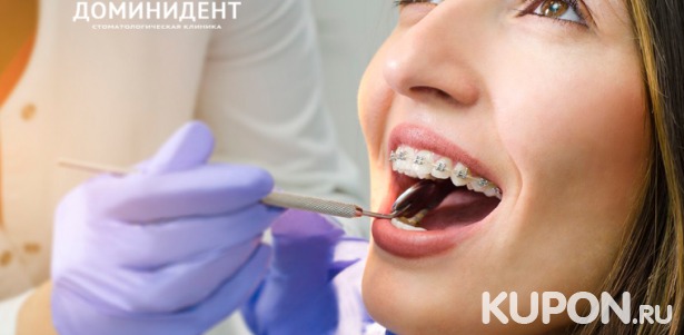 Установка ортодонтической съемной пластины для ребёнка, металлических, керамических или сапфировых брекетов в многопрофильной стоматологической клинике «ДоминиДент». Скидка до 80%