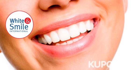 Отбеливание зубов Express, Classic или Extra в студии White & Smile: до 12 тонов! Скидка 55%