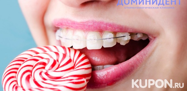 Металлические, керамические или сапфировые брекеты в многопрофильной стоматологической клинике «ДоминиДент». Скидка до 80%