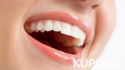 УЗ-чистка, полировка, фторирование зубов в клинике «Хороший стоматолог» (480 руб. вместо 1600 руб.)