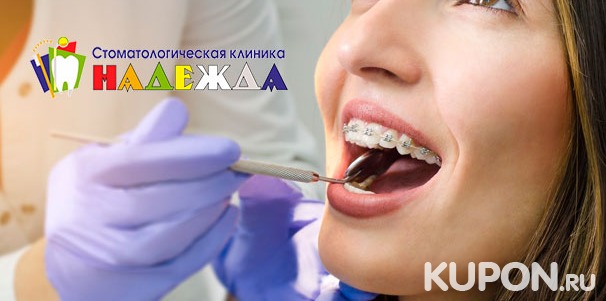 Установка керамической, металлической или комбинированной брекет-системы в стоматологической клинике «Надежда». Скидка до 62%