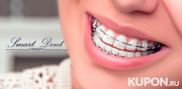 Скидка до 77% на установку металлических, сапфировых или керамических брекетов на одну или две челюсти в клинике Smart Dent