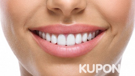 Ультразвуковая чистка и полировка зубов в стоматологической клинике «Мир улыбок» (600 руб. вместо 1500 руб.)