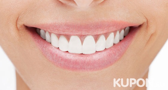 Гигиена полости рта, отбеливание зубов Amazing White, Zoom 4, Belle и Opalescence Boost в стоматологической клинике «Меда». Скидка до 84%