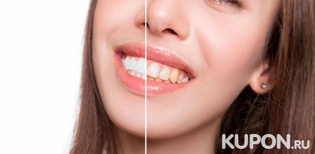 Комплексная гигиена полости рта в стоматологии «Стомсервис» со скидкой до 60%