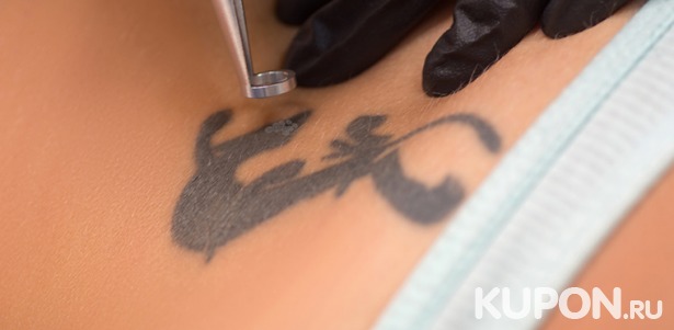 Скидка до 74% на лазерное удаление татуировки, татуажа губ, бровей или глаз в «Beautyroom на Социалистической»