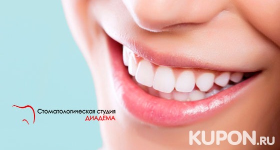 Скидка до 71% на ультразвуковую чистку зубов и лечение кариеса в клинике «Диадема»