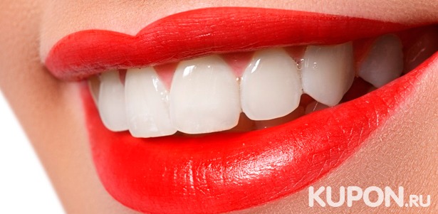 Ультразвуковая чистка зубов, отбеливание White & Perfect, лечение кариеса и установка пломбы на 1, 2 или 3 зуба в стоматологической клинике «Дент Сити». **Скидка до 86%**