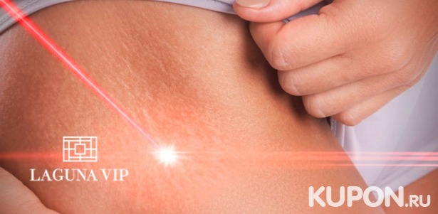 Скидка до 92% на лазерное удаление сосудистых патологий, шрамов и растяжек в клинике косметологии Laguna Vip на «Баррикадной»