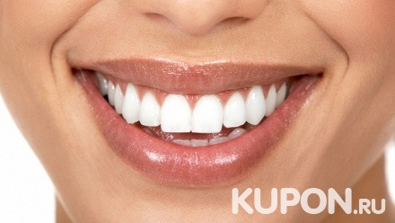 Гигиена полости рта, УЗ-чистка и снятие зубных отложений щеткой с пастой от стоматологии «Вита-стом»