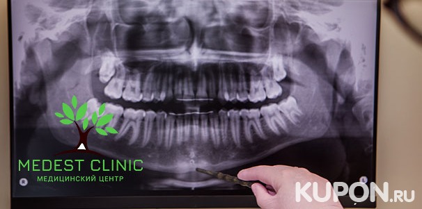 Панорамный снимок зубов, компьютерная томография челюсти или придаточных пазух носа в Medest Clinic на «Славянском бульваре». Скидка до 63%