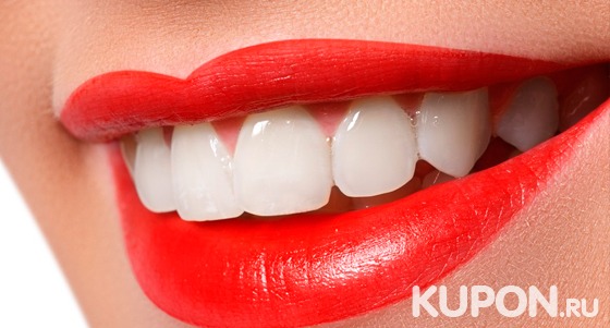 Скидка до 84% на отбеливание зубов по системе Advanced Whitening Kit и снятие налета методом Air Flow для одного или двоих в стоматологической клинике «ГалаДент»