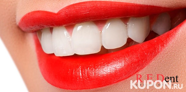 УЗ-чистка зубов + полировка, шлифовка и фторирование, а также консультация стоматолога в стоматологическом центре R.E.Dent. Скидка 81%